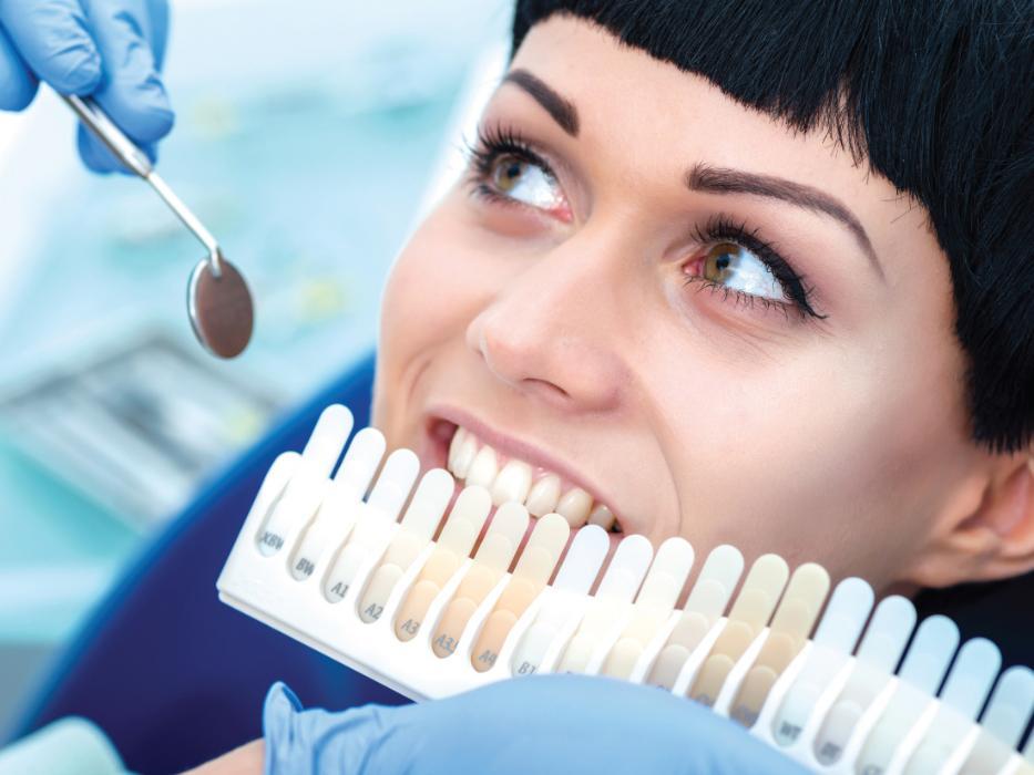 woman with teeth shade guide for whitening