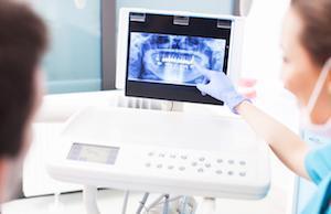 dentist showing xray | dentist in aurora il