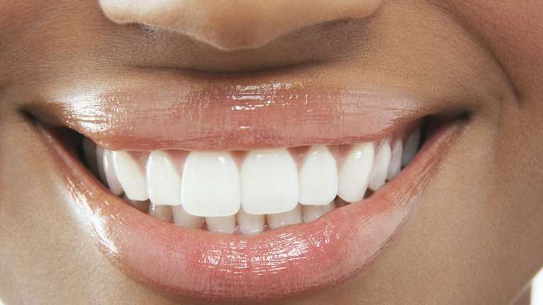 Lady's smile after getting dental bridges from Prairie Dental Care